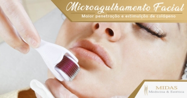Microagulhamento Facial - Maior Penetração e Estímulo de Colágeno