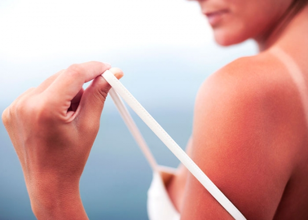 Saiba como hidratar a pele prejudicada pelo sol e evitar que a pele descasque.