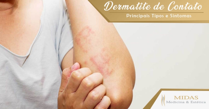 dermatite de contato midas medicina estética no centro rj