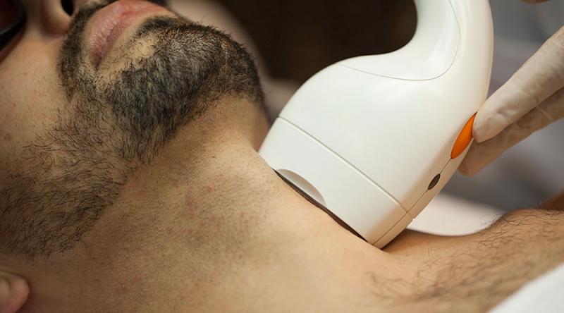 Sem preconceito, homens procuram a depilação a laser - Midas