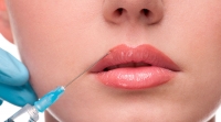 Bioplastia Labial - Deixe seus lábios mais bonitos!