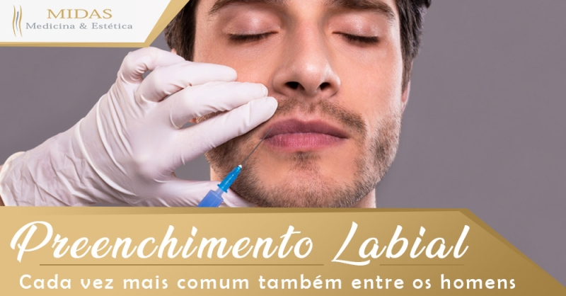 Preenchimento Labial - Cada vez mais comum também entre os Homens
