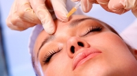 O Botox além de tratar rugas já existentes, ajuda a prevenir os sinais do envelhecimento.